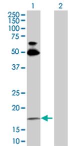 RHOB Polyclonal Antibody, MaxPab™