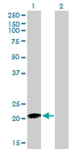 RHOC Monoclonal Antibody (2E12)