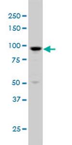 ARHGAP6 Antibody in Western Blot (WB)