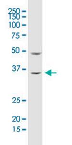 ARHGDIA Monoclonal Antibody (1G5-2F3)