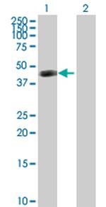ART3 Polyclonal Antibody, MaxPab™