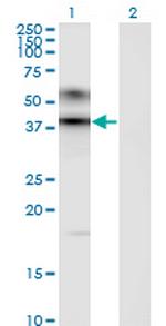 ART3 Monoclonal Antibody (1D2)