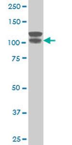 ARVCF Antibody in Western Blot (WB)