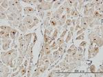ASAH1 Monoclonal Antibody (2C9)