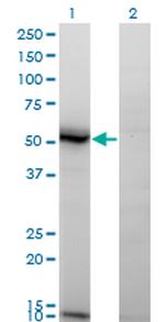 ASAH1 Antibody in Western Blot (WB)