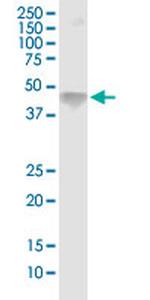 ASGR1 Monoclonal Antibody (1G4)
