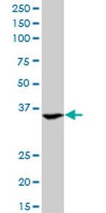 ASGR2 Antibody in Western Blot (WB)