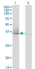 ASGR2 Antibody in Western Blot (WB)