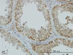 ASNA1 Antibody in Immunohistochemistry (Paraffin) (IHC (P))