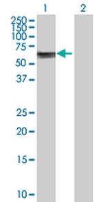 ASNS Polyclonal Antibody, MaxPab™