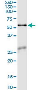 ASNS Monoclonal Antibody (2B3)