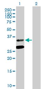 ASPA Polyclonal Antibody, MaxPab™