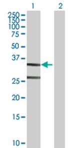 ASPA Polyclonal Antibody, MaxPab™