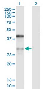 ASPH Polyclonal Antibody, MaxPab™
