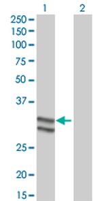 SERPINC1 Monoclonal Antibody (2B12)