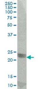 ATF3 Monoclonal Antibody (8D8)