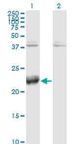 ATF3 Monoclonal Antibody (8G5)