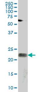 ATF3 Monoclonal Antibody (6G11)