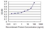 ATM Antibody in ELISA (ELISA)