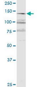 RERE Monoclonal Antibody (2F2)