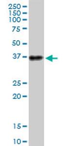 ATP1B3 Antibody in Western Blot (WB)