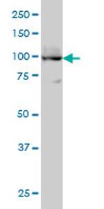 ATP2A3 Antibody in Western Blot (WB)