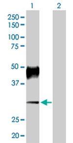 ATP4B Polyclonal Antibody, MaxPab™