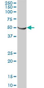 ATP5B Antibody in Western Blot (WB)
