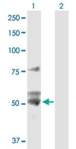ATP5B Polyclonal Antibody, MaxPab™