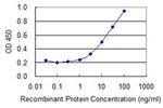 ATP6V1B1 Monoclonal Antibody (3G11)