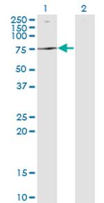 ATP6V1B2 Monoclonal Antibody (2A5)