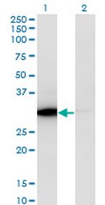 ATP6V1E1 Monoclonal Antibody (4E11)