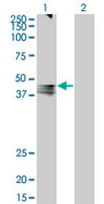 AVPR1A Monoclonal Antibody (7B8)