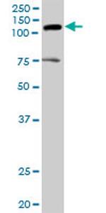 AXL Antibody in Western Blot (WB)