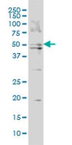 BAAT Monoclonal Antibody (5B6)