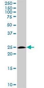 BAK1 Antibody in Western Blot (WB)