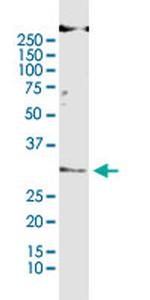 BAK1 Antibody in Immunoprecipitation (IP)