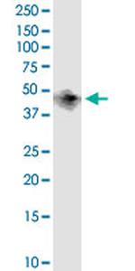 BCAT1 Monoclonal Antibody (1F8)