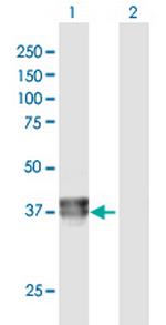 BCAT2 Polyclonal Antibody, MaxPab™