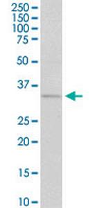 CCND1 Antibody in Western Blot (WB)