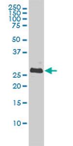 BCL2L1 Antibody in Western Blot (WB)