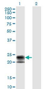 TNFRSF17 Monoclonal Antibody (1F10)
