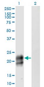 TNFRSF17 Monoclonal Antibody (3H6)