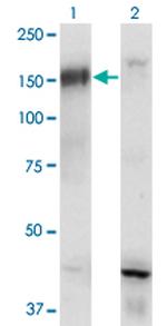 BCR Antibody in Western Blot (WB)