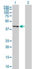 BCS1L Polyclonal Antibody, MaxPab™