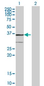 BDH1 Polyclonal Antibody, MaxPab™