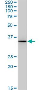 BDH1 Monoclonal Antibody (4B3)