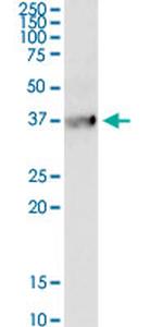 BDKRB1 Monoclonal Antibody (3A2)