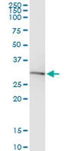 BDNF Antibody in Immunoprecipitation (IP)