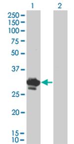 BDNF Antibody in Western Blot (WB)
